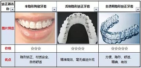 隐形矫正