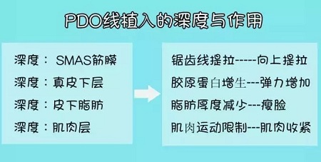 关于*雕，你想了解的都在这里！