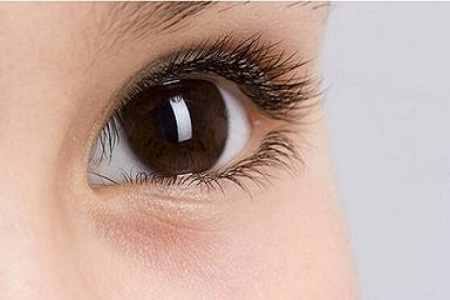 成都双眼皮修复有哪些方法