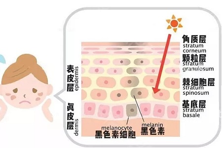 祛斑的这些坑你了解了吗