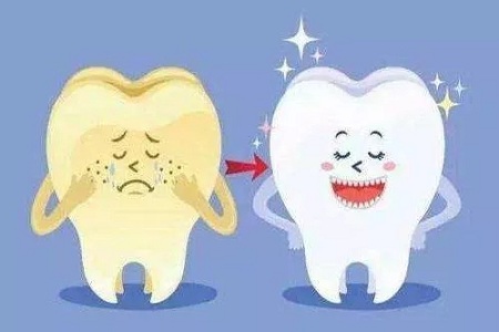 牙齿美白有哪些比较好的方法