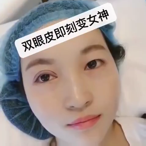 天津美莱不做双眼皮，你永远不知道自己会有多美