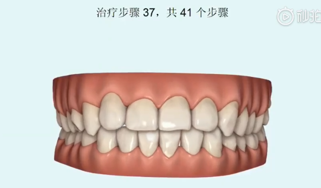 天津美莱口腔正畸中心，陪您一起见证奇迹的发生