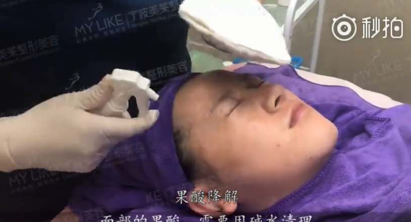 宁波美莱戳视频看看小姐姐的体验过程吧