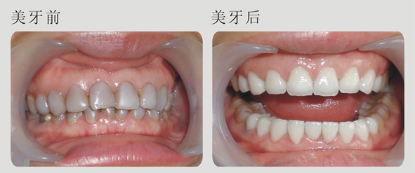 17-19102P925080-L.jpg