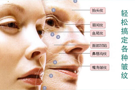 除皱针