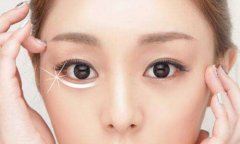 深圳美莱祛除眼袋的更好办法是什么？