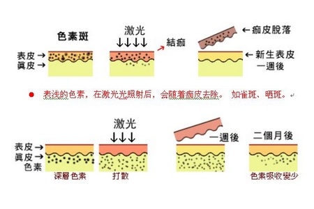 祛斑方法有哪几种？这些祛斑小妙招你需要掌握