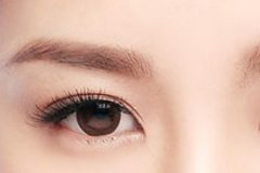 北京医院做双眼皮方式有几种，效果自然吗