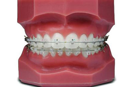 美莱隆重推出双旦福利，报名体验牙齿矫正黑科技iTero 口扫