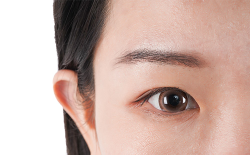 激光治疗黑眼圈效果怎么样，术后要注意什么